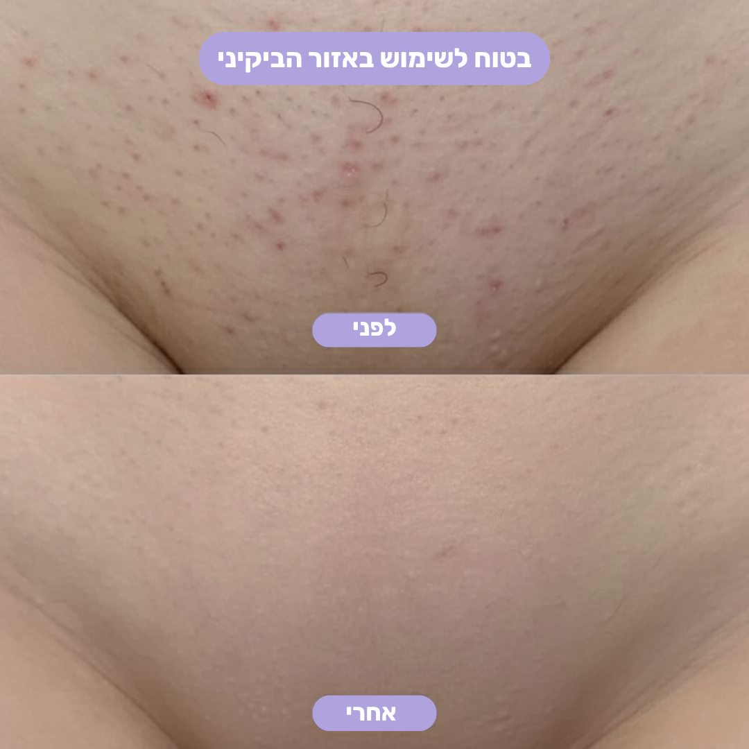 מכונת הגילוח של LADIVA