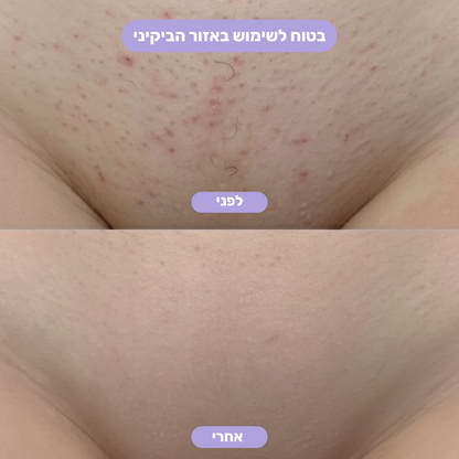 מכונת הגילוח של LADIVA